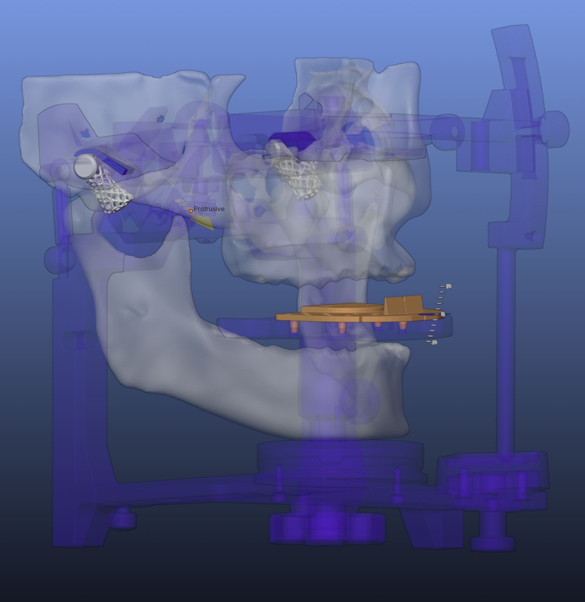 Restorative Dentistry Chesterfield and Sheffield